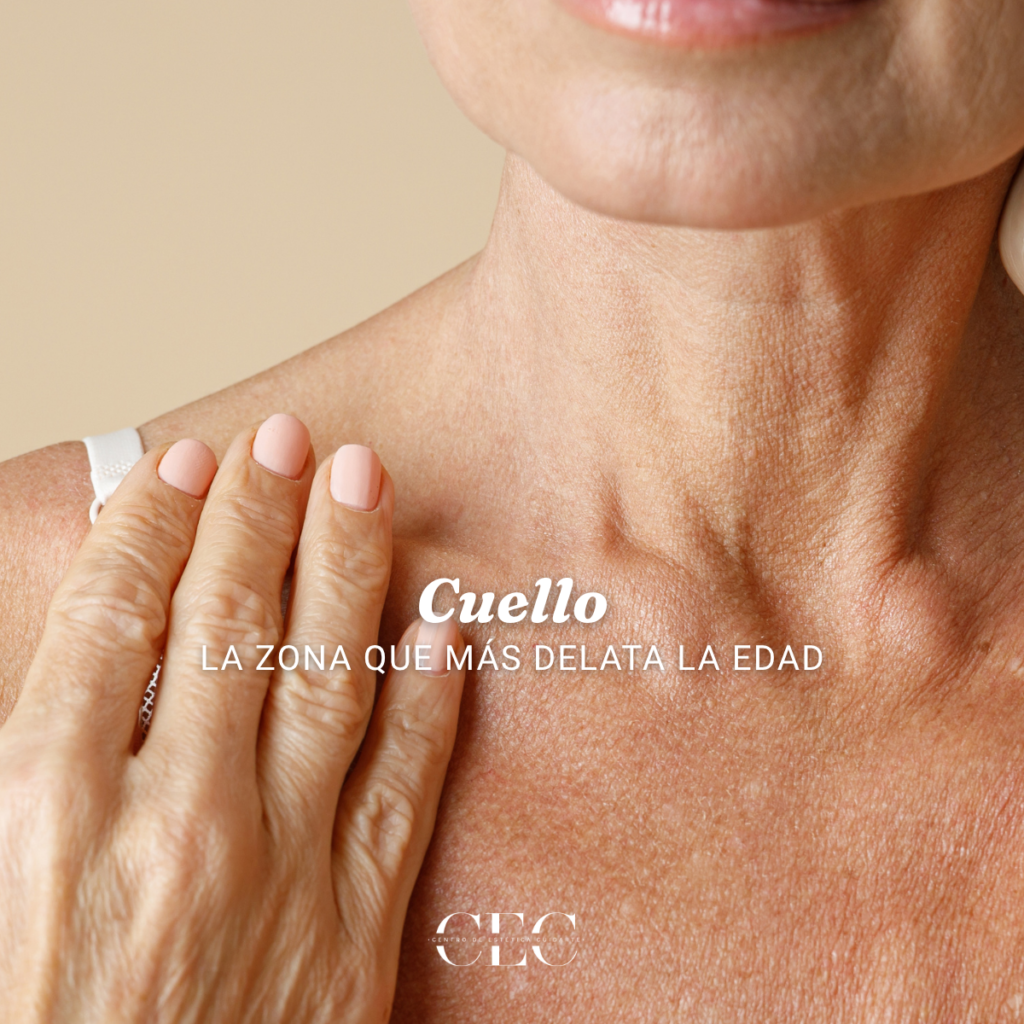¿Por qué el cuello envejece antes que otras zonas? Opciones para mejorar su apariencia